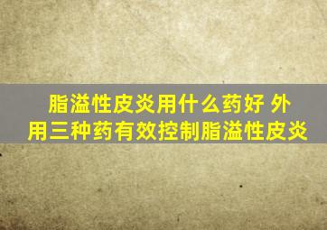 脂溢性皮炎用什么药好 外用三种药有效控制脂溢性皮炎